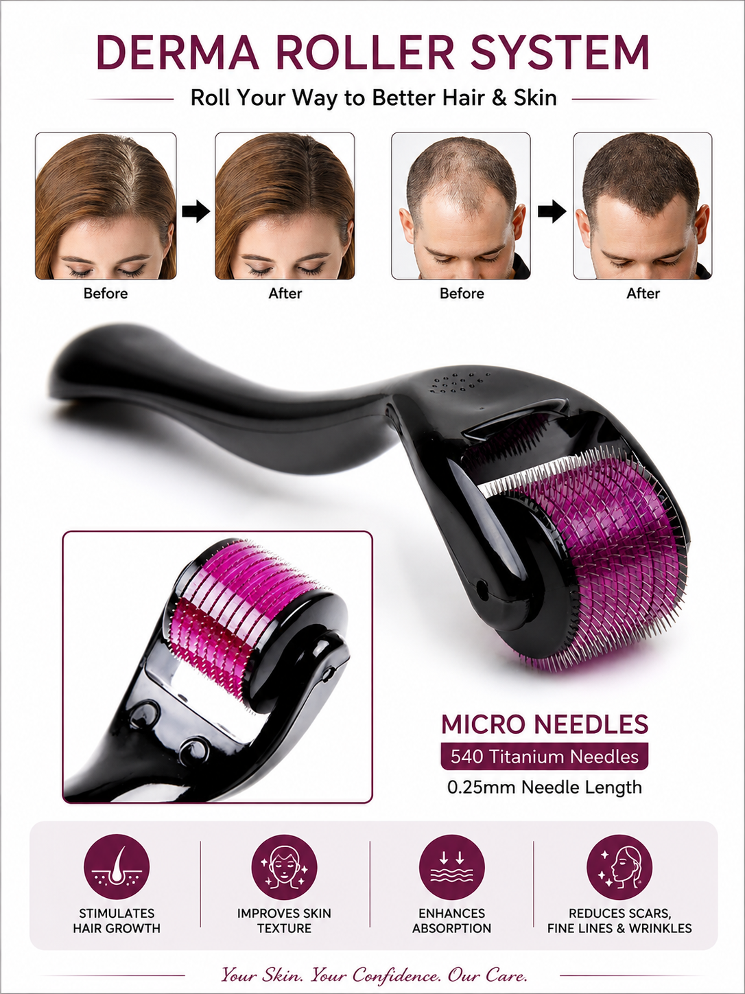 Sikasha Derma Roller — 540 Needles 0.5mm | Hair Regrowth, Scalp Massage & Blood Circulation